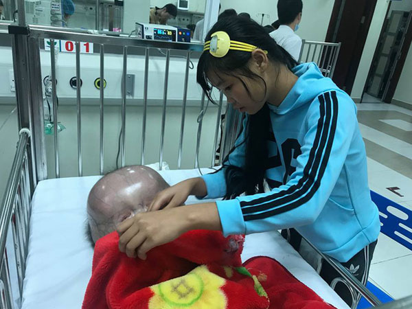 Video: Tâm sự của mẹ bé trai có đầu to như quả bóng