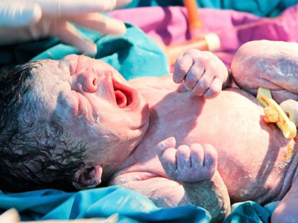 Quá ngày dự sinh 2 tuần vẫn 'lì' không đến bệnh viện, mẹ suýt hại chết con