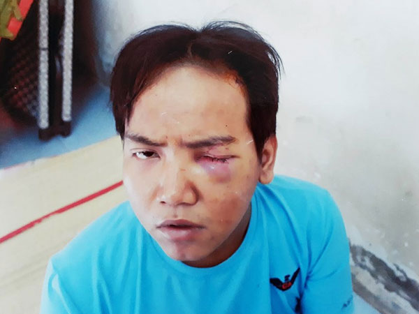 Hé lộ nguyên nhân bảo vệ dân phố sát hại bé trai 6 tuổi