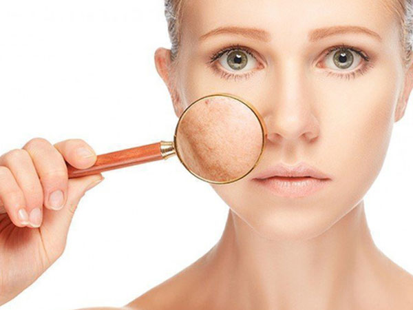 5 loại sản phẩm làm đẹp mà các quý cô da nhạy cảm có chết cũng đừng nên sử dụng