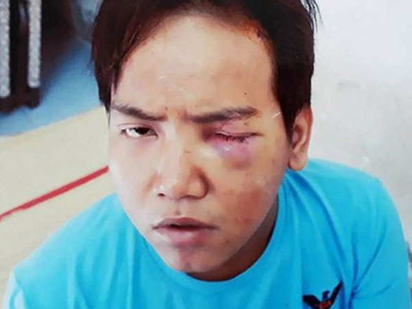 Khi nào bệnh nhân tâm thần phân liệt trở thành sát nhân tàn bạo?