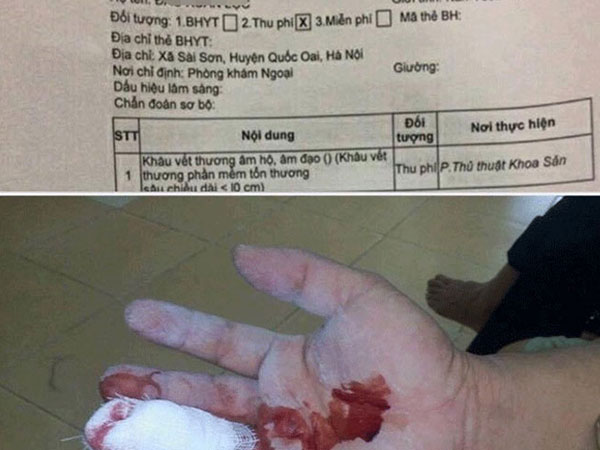 Bi hài nam bệnh nhân bị rách tay được chỉ định khâu... 'cô bé'