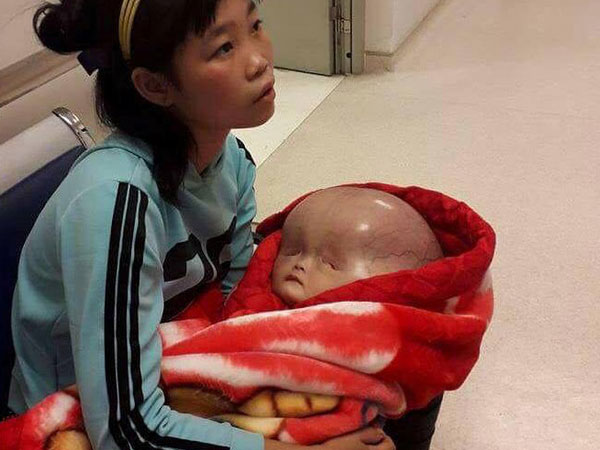 Người mẹ bị tố không đồng ý đưa con bị não úng thủy sang Singapore chữa trị lên tiếng