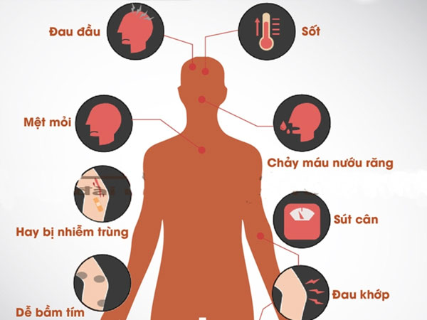 10 dấu hiệu ung thư máu mọi người cần cảnh giác