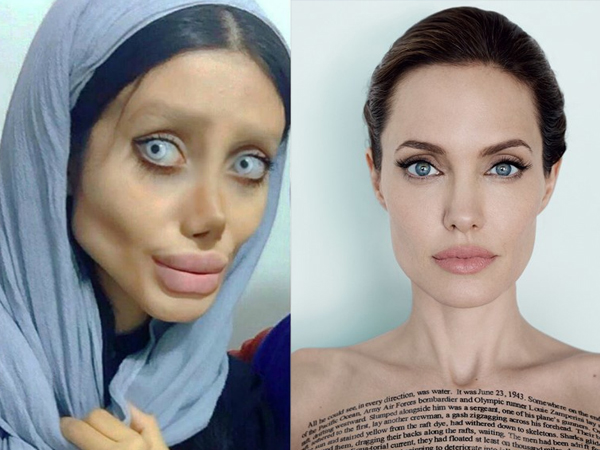 Cô gái phẫu thuật thẩm mỹ hơn 50 lần để nhìn giống Angelina Jolie, kết quả trả về gia tinh Dobby