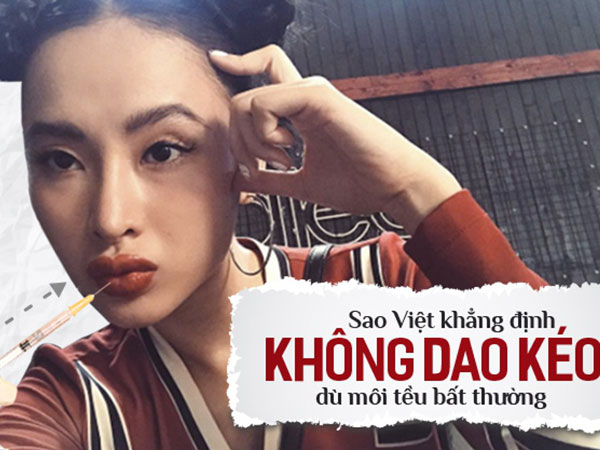 Rõ ràng là môi tều thế kia mà sao Việt nào cũng 'chối đây đẩy' khi dính nghi vấn đụng chạm dao kéo