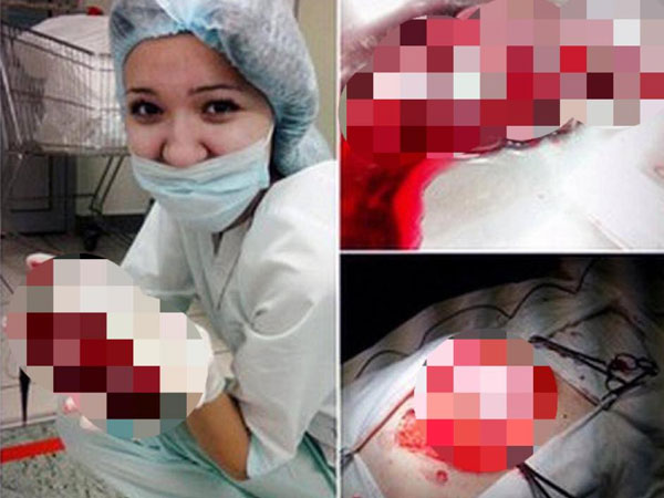 Nữ y tá Nga chơi đùa với nội tạng bệnh nhân gây phẫn nộ