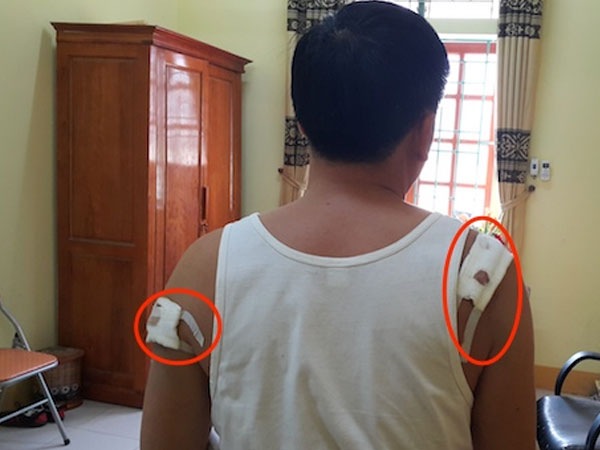 Trưởng công an nã bốn phát đạn vào chủ tịch xã bị khởi tố