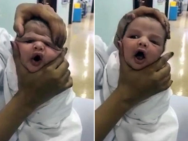 Y tá vừa cười vừa bóp mặt trẻ sơ sinh đến biến dạng