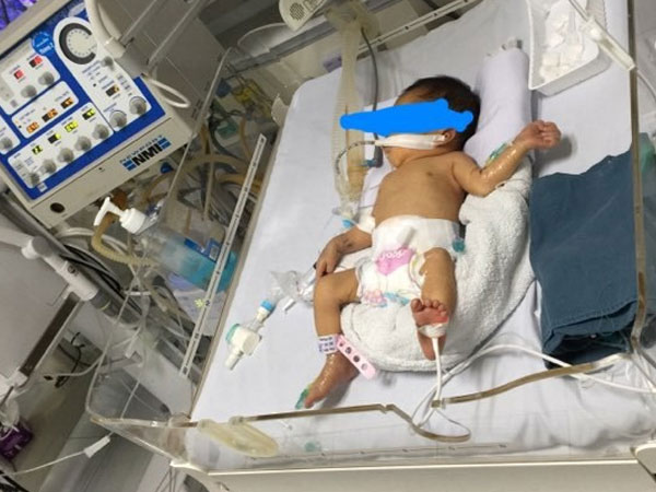 Bé gái 32 tuần tuổi nghi bị mẹ đẻ đặt thuốc ép cho chết để sinh non: Các bác sĩ tiên lượng xấu