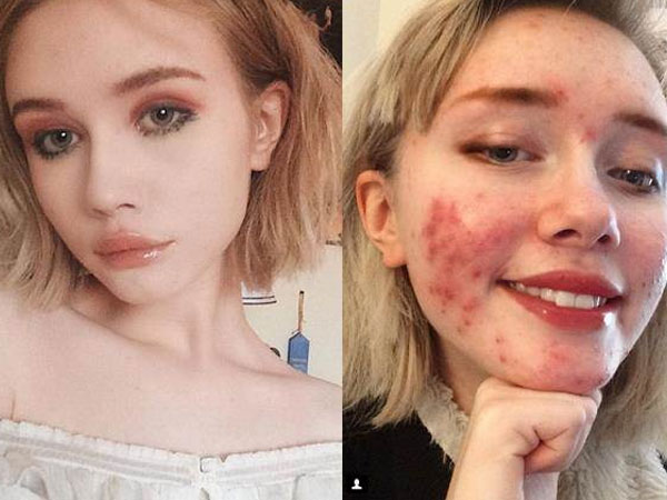 Mệt mỏi vì 'sống ảo', hot girl 17 tuổi lộ mặt thật khiến dân tình sốc nặng