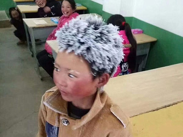 Cậu bé bị đóng băng toàn bộ tóc vì trời giá rét