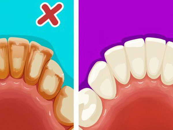 Ghi nhớ 6 mẹo đơn giản để có một hàm răng trắng như sứ
