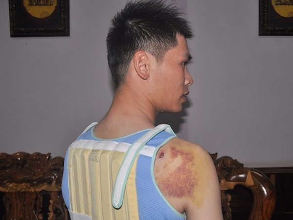 Bí thư xã mâu thuẫn ngoài xã hội, con trai đến bắn người nhập viện