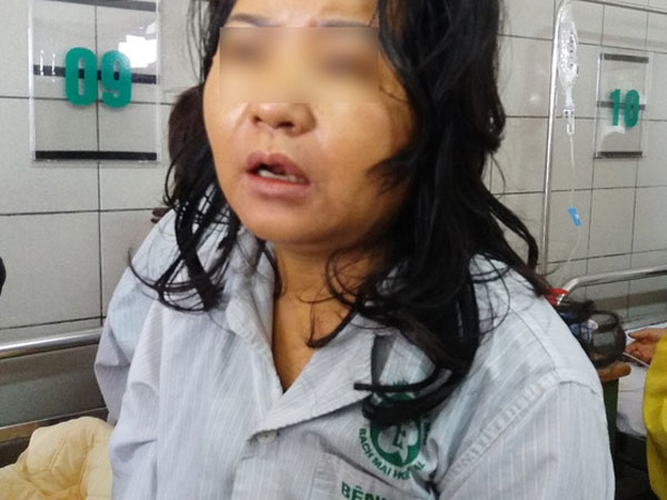 Một phụ nữ nguy kịch, xơ gan nghi do sử dụng thực phẩm chức năng để giảm cân