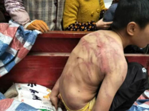 Bị bố mẹ đánh, bé trai cởi trần ngủ suốt đêm ngoài trời âm 2 độ