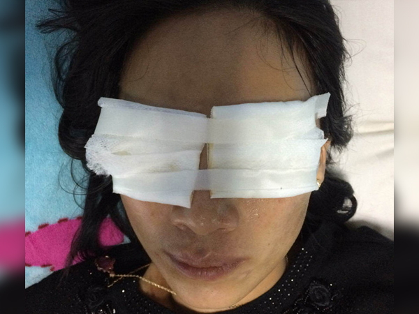 Mẹ chồng tạt axit con dâu được phát hiện đã chết tại nhà
