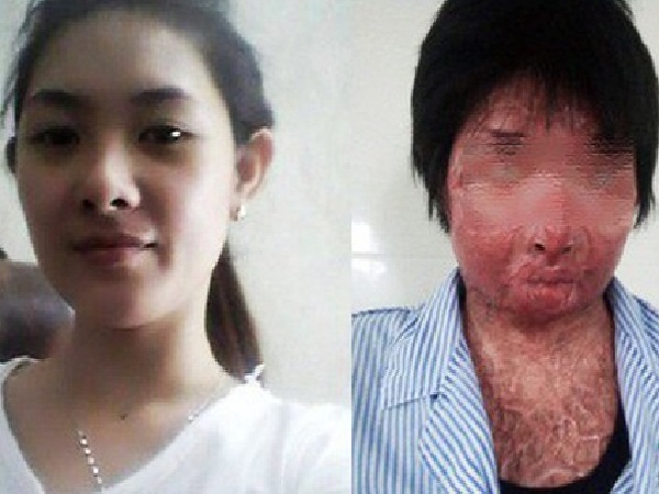 Cuộc sống tươi mới của người phụ nữ xinh đẹp bị chồng tẩm xăng đốt