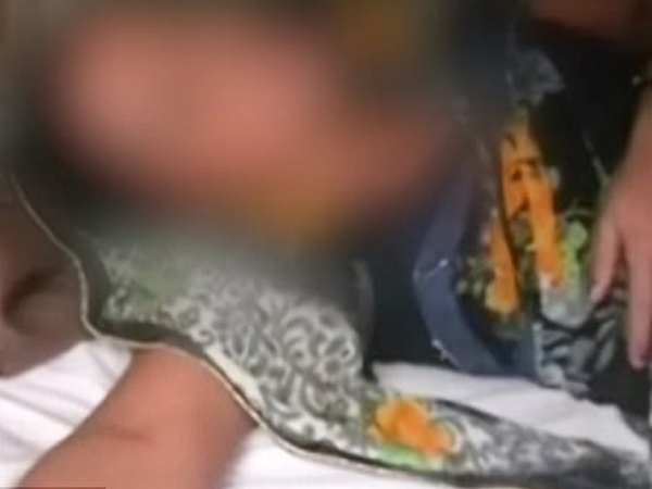 Hãi hùng chồng đổ axit vào 'vùng kín' của vợ vì không được 'yêu'