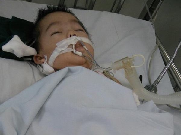 Vụ bé 8 tháng bị điều dưỡng tiêm nhầm thuốc: Cháu bé đang có dấu hiệu chết não