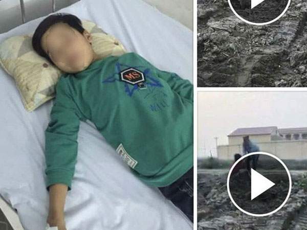 Thực hư sự việc bé trai ăn trộm ngô bị đánh chấn thương sọ não