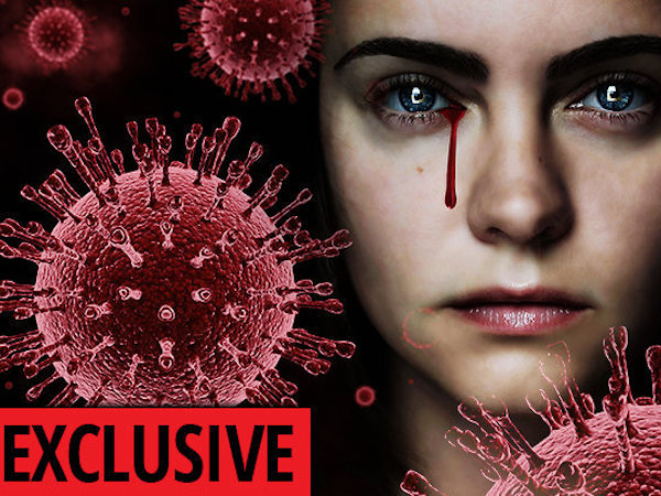 Cảnh báo sốc: Bệnh chảy máu mắt nguy cơ thành đại dịch giống Ebola
