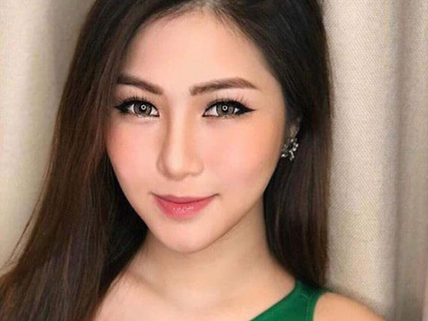 Ca sĩ Hương Tràm gần như bị mất thị giác, đi lại phải có người dìu