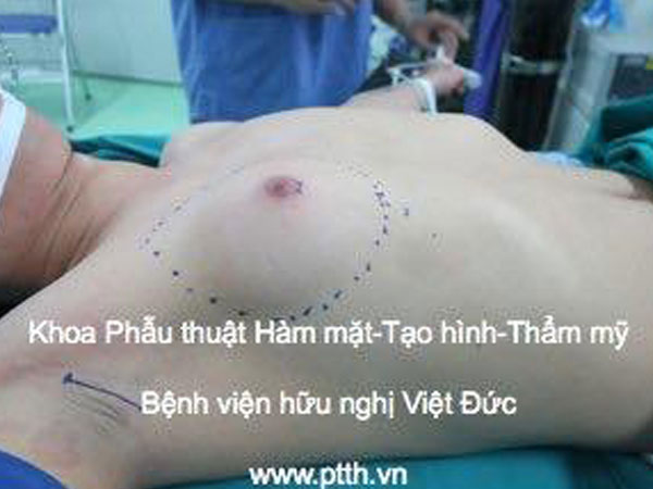 Chàng trai trẻ khổ sở với bộ ngực đầy đặn như nữ giới