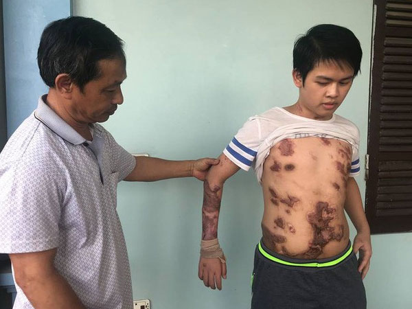 Cậu bé 16 tuổi sống sót sau vụ cháy xưởng bánh kẹo khiến 8 người tử vong ở Hà Nội bây giờ ra sao