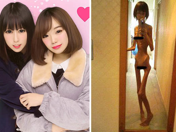 Sốc: Cô gái trẻ thân hình gầy xác ve vì bị ông nội bỏ đói