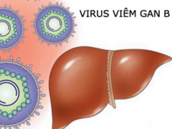 5 dấu hiệu cảnh báo viêm gan B biến thành ung thư gan bạn cần biết càng sớm càng tốt