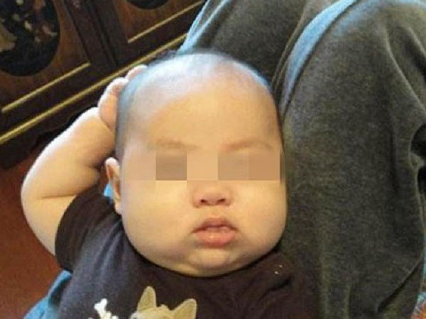 Con liên tục đưa tay lên gãi đầu, bố mẹ cho rằng đó là cử chỉ hết sức bình thường nhưng rồi nhận ra sự thật đáng sợ