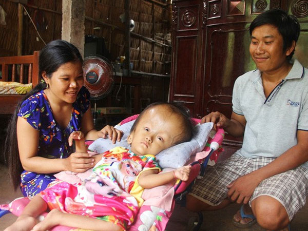 Phép màu kỳ diệu đến với cặp vợ chồng trẻ nuôi con gái 4 tuổi bị não úng thủy, đầu to gấp 3 lần trong năm mới