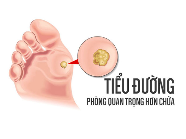 Không muốn bị tiểu đường, cần tránh những yếu tố gây bệnh ngay từ trong 'trứng nước'