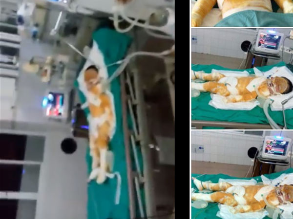 Thái Bình: Chập điện cháy nhà giữa đêm, vợ chồng bỏng nặng, bé gái 4 tuổi nguy kịch