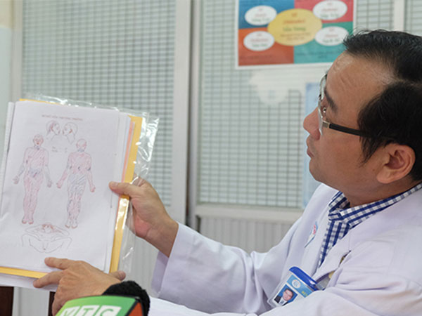 4 nạn nhân vụ nổ khí hầm cầu nhà vệ sinh: Một người bỏng 96% cơ thể, tiên lượng xấu