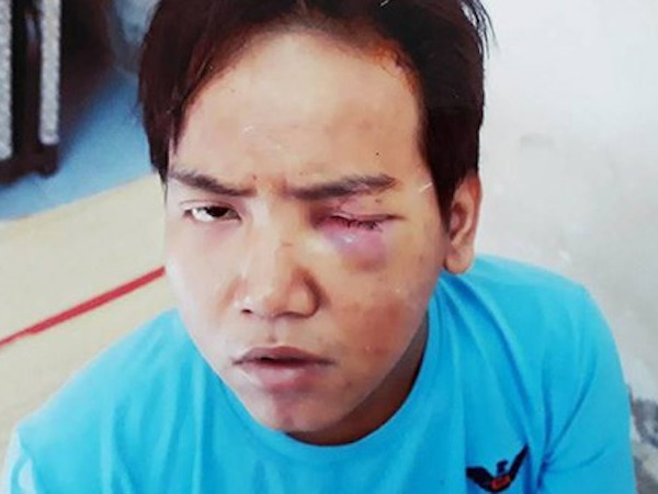 Bảo vệ dân phố sát hại bé trai 6 tuổi ở Sài Gòn bị tâm thần phân liệt