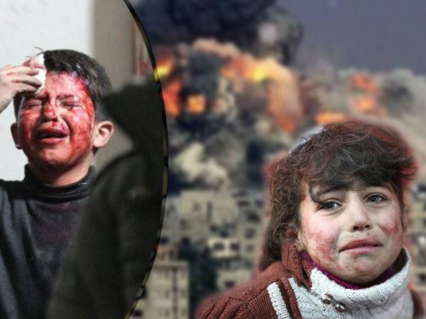 Thảm cảnh của những đứa trẻ tại 'thánh địa' chết chóc Syria: Nỗi đau của các em vẫn chưa có hồi kết