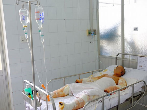 Vụ điện giật khi đang dựng giàn giáo: Một người chết, một người phải đoạn tứ chi