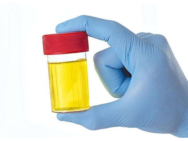 Xem nước tiểu đoán tuổi thọ con người
