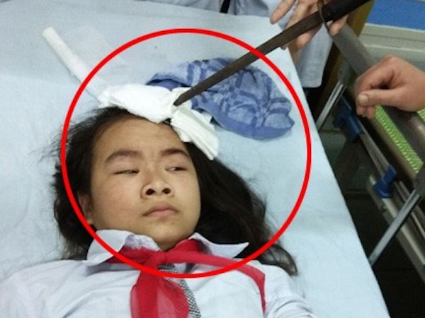 Hà Nam: Nữ sinh bị bạn phi dao trúng người, Bộ yêu cầu xác minh