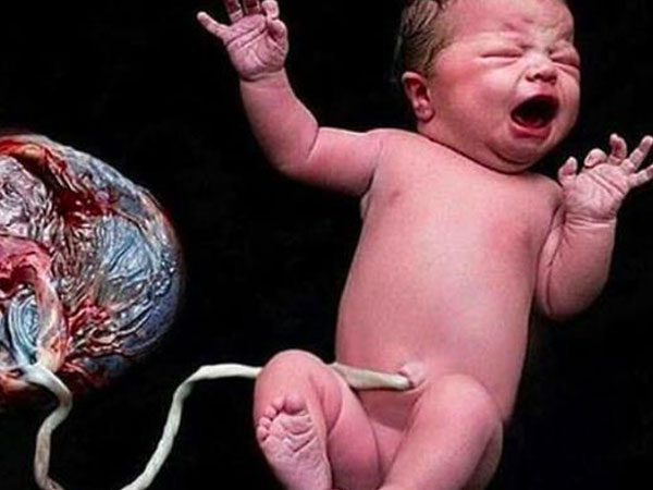 Sinh con 'thuận tự nhiên', không cắt rốn: Đừng đem sinh mệnh con làm chuột bạch câu like!