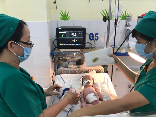 Thai phụ bất ngờ chuyển dạ trên đường xuống Sài Gòn, bé gái vừa chào đời đã bị lòi ruột ngoài ổ bụng nguy kịch
