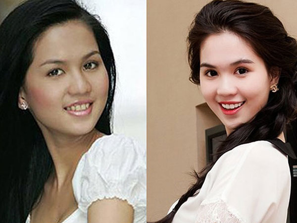 Chỉ cần làm răng, loạt sao Việt đã lên đời nhan sắc thế này!