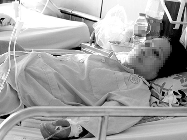 4 lần chết đi sống lại vì hóc hạt mãng cầu