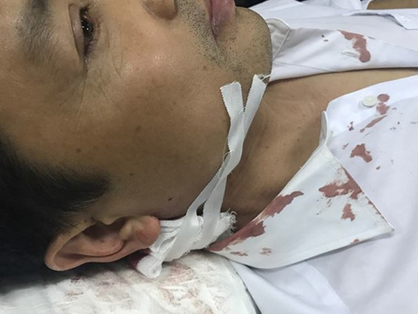 Cầm dao bầu xông vào trụ sở chém trọng thương CSGT