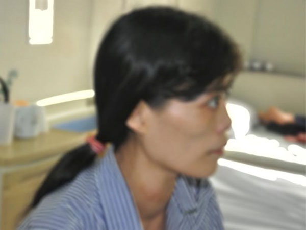 Tự đắp thuốc chữa bướu cổ, da rơi từng mảng