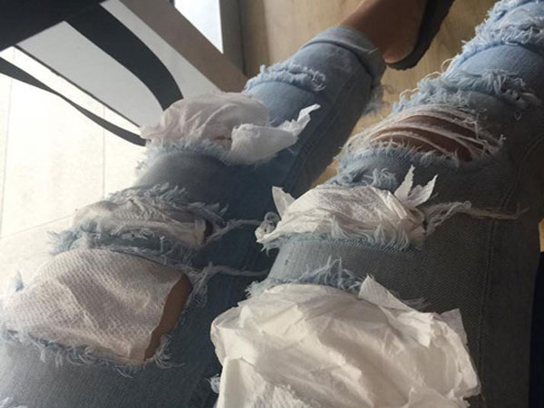 Chàng trai dùng giấy ăn 'vá' quần cho bạn gái