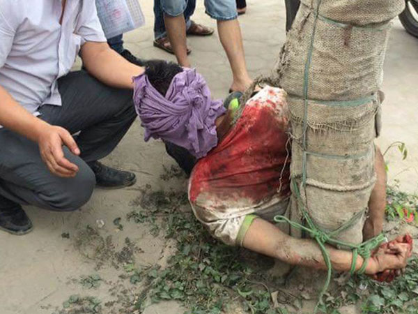Lao đầu vào ô tô tự tử bất thành, nam thanh niên bị trói vào gốc cây