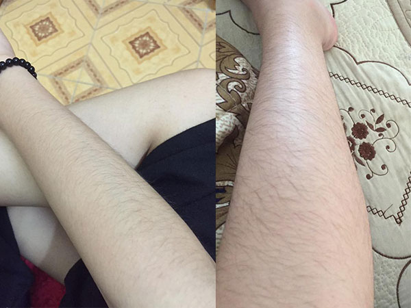 Chùm ảnh: Còn gì khổ hơn những cô nàng phận là con gái nhưng lông mọc còn rậm hơn con trai